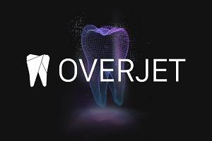 overjet